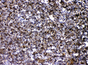 ARHGEF1 Rabbit Polyclonal Antibody