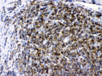 ARHGEF1 Rabbit Polyclonal Antibody