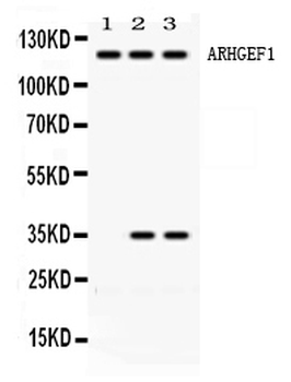 ARHGEF1 Rabbit Polyclonal Antibody