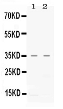 CXCL16 Antibody