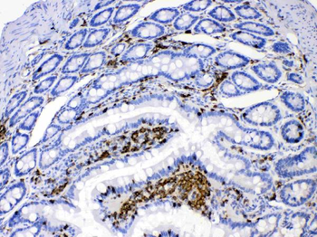 DHODH Rabbit Polyclonal Antibody