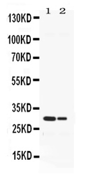 Neutrophil Elastase/ELANE Rabbit Polyclonal Antibody
