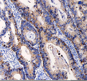 EpCAM Rabbit Polyclonal Antibody