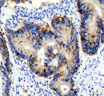 EpCAM Rabbit Polyclonal Antibody