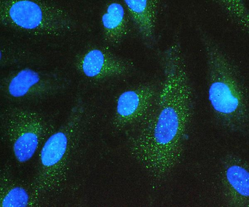 GNB1 Rabbit Polyclonal Antibody