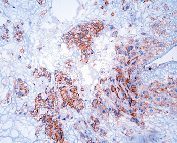 GNB1 Rabbit Polyclonal Antibody