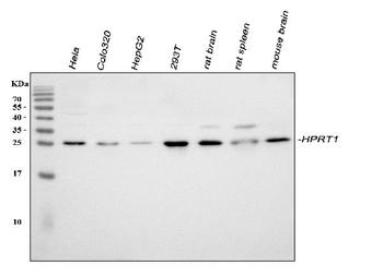 HPRT/HPRT1 Rabbit Polyclonal Antibody