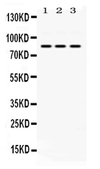 KRIT1 Rabbit Polyclonal Antibody