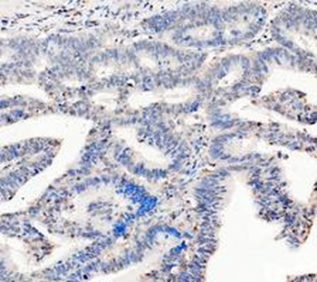 LDHA Antibody