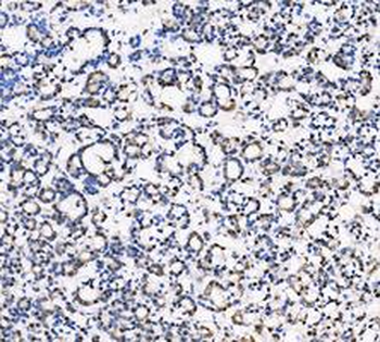 LDHA Antibody
