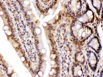 LDHA Antibody
