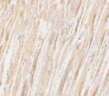 LDHA Antibody