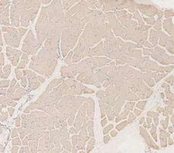 LDHA Antibody