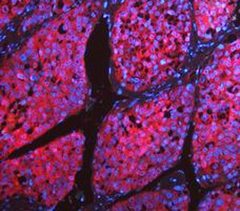 LDHA Antibody