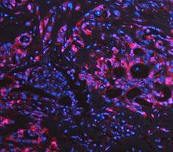 LDHA Antibody