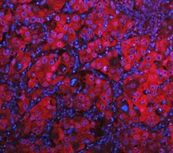 LDHA Antibody