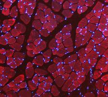 LDHA Antibody