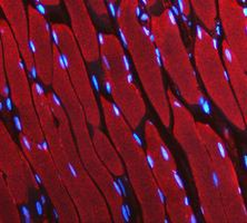 LDHA Antibody