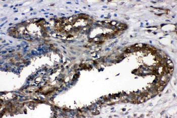 LDHA Antibody