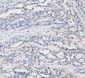LDHA Antibody