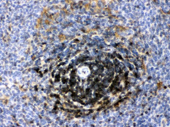 Lactate Dehydrogenase B/LDHB Antibody