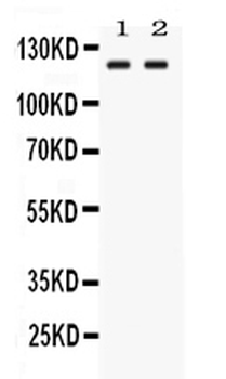 LRIG3 Rabbit Polyclonal Antibody