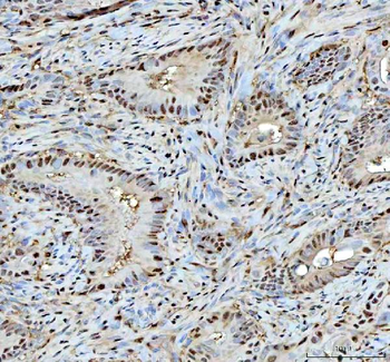 Proteasome 20S C2/PSMA1 Antibody