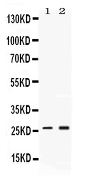 Proteasome 20S alpha 2/PSMA2 Rabbit Polyclonal Antibody