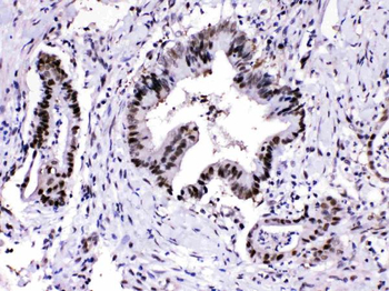 Proteasome 20S alpha 3/PSMA3 Rabbit Polyclonal Antibody