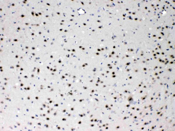 Proteasome 20S alpha 3/PSMA3 Rabbit Polyclonal Antibody