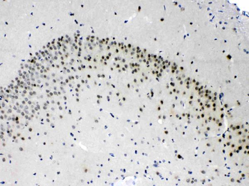 Proteasome 20S alpha 3/PSMA3 Rabbit Polyclonal Antibody