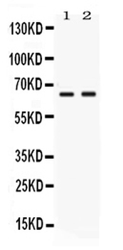 PVRL4/NECTIN4 Rabbit Polyclonal Antibody