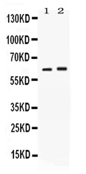 SCTR Rabbit Polyclonal Antibody