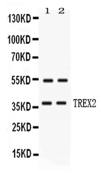TREX2 Rabbit Polyclonal Antibody