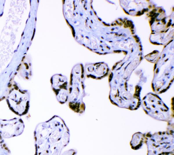 AFF4 Rabbit Polyclonal Antibody