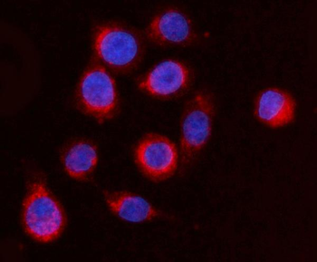 ARFGAP1 Rabbit Polyclonal Antibody