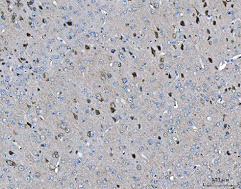ARFGAP1 Rabbit Polyclonal Antibody