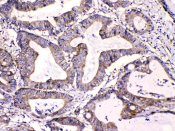 Calpastatin/CAST Rabbit Polyclonal Antibody
