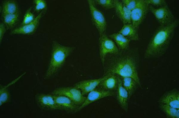 Diazepam Binding Inhibitor/DBI Rabbit Polyclonal Antibody