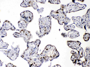 Diazepam Binding Inhibitor/DBI Rabbit Polyclonal Antibody