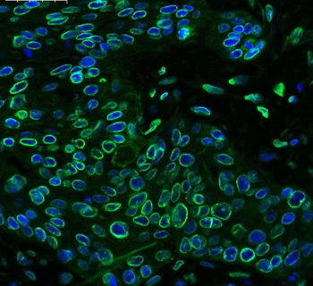 Emerin/EMD Antibody