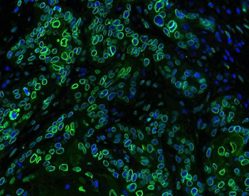 Emerin/EMD Antibody