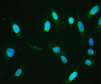 Emerin/EMD Antibody