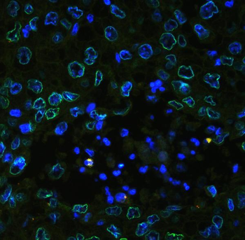 Emerin/EMD Antibody