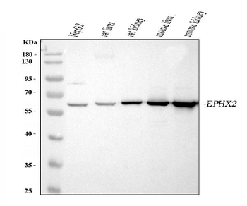EPHX2 Rabbit Polyclonal Antibody