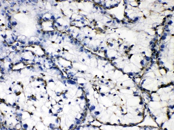 GAA Rabbit Polyclonal Antibody