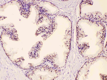 GAA Rabbit Polyclonal Antibody