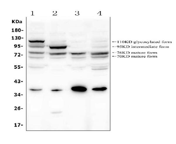 GAA Rabbit Polyclonal Antibody
