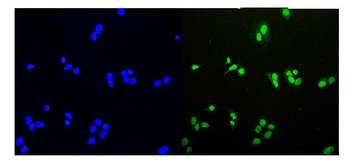 HDGF Rabbit Polyclonal Antibody