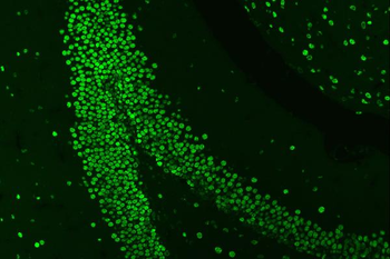 HnRNP A1/HNRNPA1 Antibody